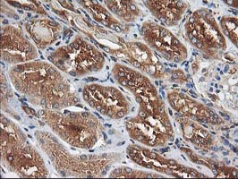 IHC of paraffin-embedded Human Kidney tissue using anti-HARS2 mouse monoclonal antibody.