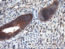 IHC of paraffin-embedded Human endometrium tissue using anti-HARS2 mouse monoclonal antibody.