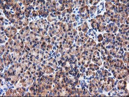 IHC of paraffin-embedded Human pancreas tissue using anti-HARS2 mouse monoclonal antibody.