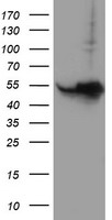 HEK293T cells were transfected with the pCMV6-ENTRY control (Left lane) or pCMV6-ENTRY HARS2 (Right lane) cDNA for 48 hrs and lysed. Equivalent amounts of cell lysates (5 ug per lane) were separated by SDS-PAGE and immunoblotted with anti-HARS2.