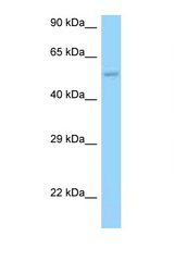 HARS2 / HisRS antibody LS-C146156 Western blot of PANC1 Cell lysate. Antibody concentration 1 ug/ml.