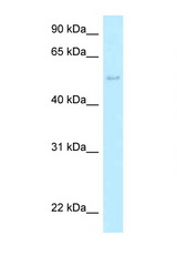 HARS2 / HisRS antibody LS-C145946 Western blot of HeLa Cell lysate. Antibody concentration 1 ug/ml.