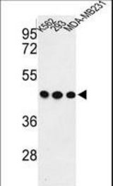 Western blot of GPA33 Antibody in K562, 293, MDA-MB231 cell line lysates (35 ug/lane). GPA33 (arrow) was detected using the purified antibody.