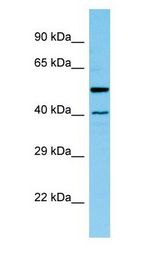 HAT1 antibody Western Blot of Rat Pancreas.