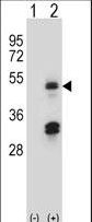 Western blot of HAT1 (arrow) using rabbit polyclonal HAT1 Antibody. 293 cell lysates (2 ug/lane) either nontransfected (Lane 1) or transiently transfected (Lane 2) with the HAT1 gene.