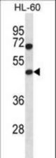 HAT1 Antibody western blot of HL-60 cell line lysates (35 ug/lane). The HAT1 antibody detected the HAT1 protein (arrow).