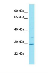Western blot of Human Fetal Liver. HAUS2 antibody dilution 1.0 ug/ml.