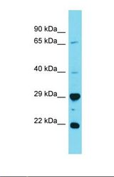 Western blot of Human 721_B. HAUS2 antibody dilution 1.0 ug/ml.