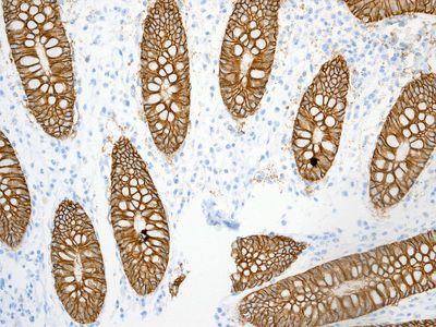 IHC of paraffin-embedded human colon tissue using anti-GPA33 antibody.