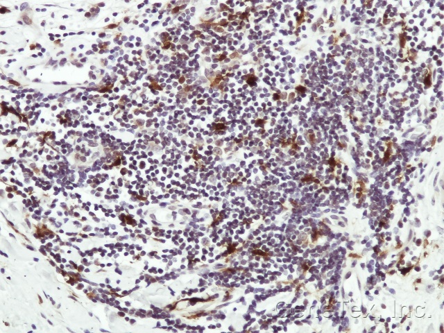 IHC of paraffin-embedded Human lymph tissue using HAUS8 antibody at 1:50 dilution.