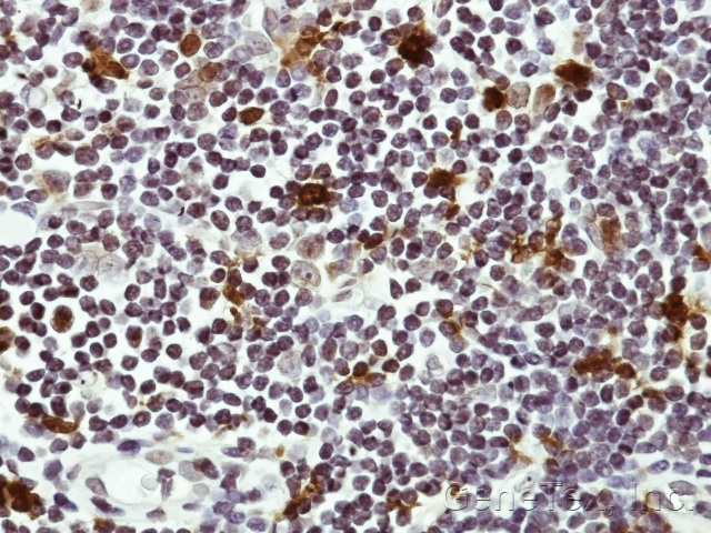 IHC of paraffin-embedded Human lymph tissue using HAUS8 antibody at 1:50 dilution.
