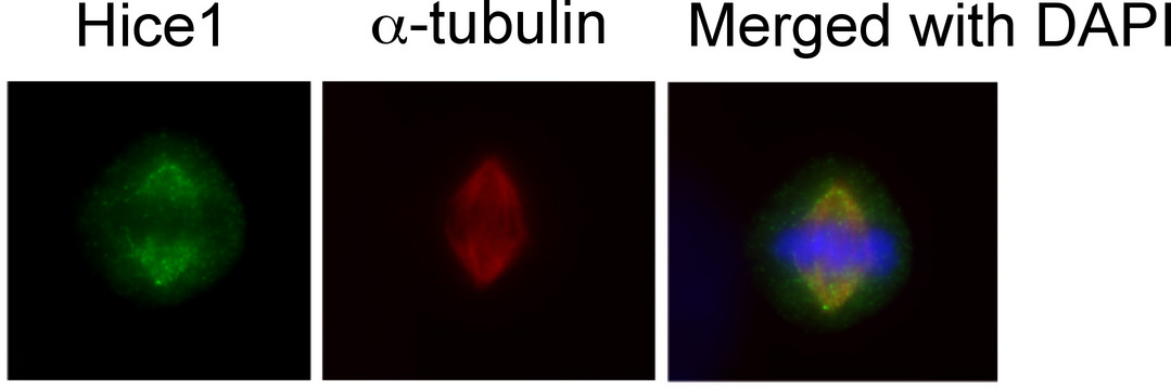 Immunofluorescence of human osteosarcoma cell line U2OS using HAUS8 antibody at 1:50-1:200 dilution.
