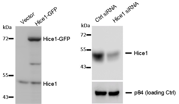 WB to detect cellular Hice1 and Hice1-GFP expressed in human osteosarcoma U2OS cells (left image) , and Hice1 upon siRNA treatment (right image) using HAUS8 antibody at 1:1000 dilution. Nuclear matrix protein p84 is a loading control, blotted with p84 antibody (clone 5E10) GTX70220 at 1:5000 dilution.