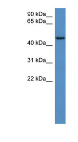 HAUS8 antibody LS-C135653 Western blot of HeLa lysate.