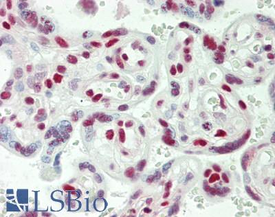 Human Placenta: Formalin-Fixed, Paraffin-Embedded (FFPE)