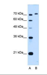 Lane A: Marker. Lane B: HepG2 cell lysate. Antibody concentration: 0.5 ug/ml. Gel concentration: 12%.