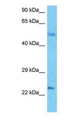 Western blot of GPAM1 Antibody with human Thymus Tumor lysate.