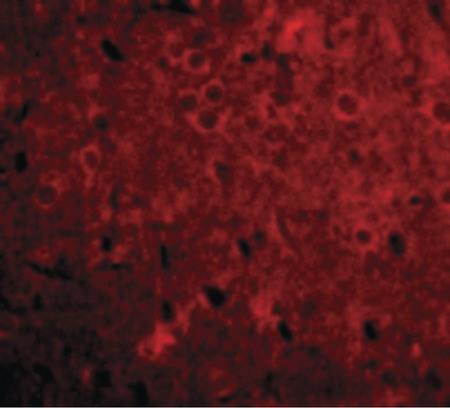 Immunofluorescence of GPAT1 in Rat Brain cells with GPAT1 antibody at 20 ug/ml.
