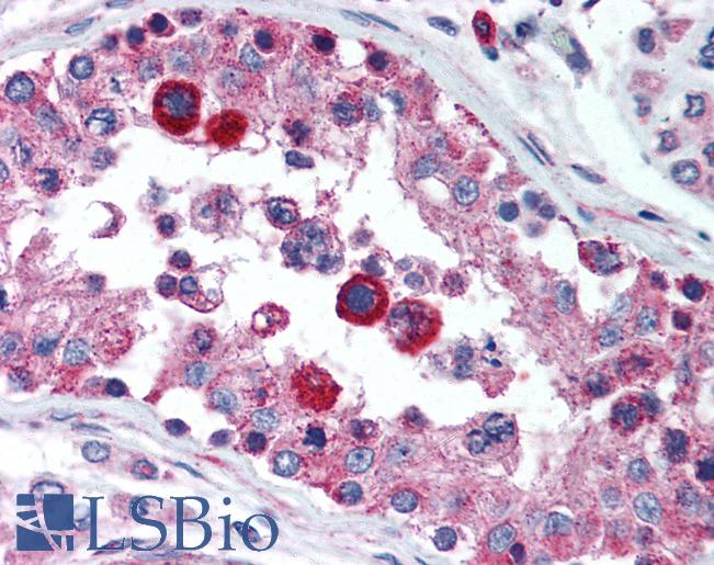 Anti-TIM-1 antibody IHC of human testis. Immunohistochemistry of formalin-fixed, paraffin-embedded tissue after heat-induced antigen retrieval. Antibody LS-B2103 concentration 5 ug/ml.