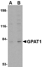 Western blot of GPAT1 in rat brain tissue lysate with GPAT1 antibody at (A) 1 and (B) 2 ug/ml.