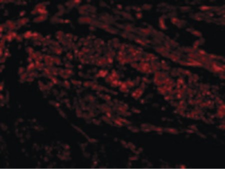 Immunofluorescence of TIM-1 in Human Uterus cells with TIM-1 antibody at 20 ug/ml.