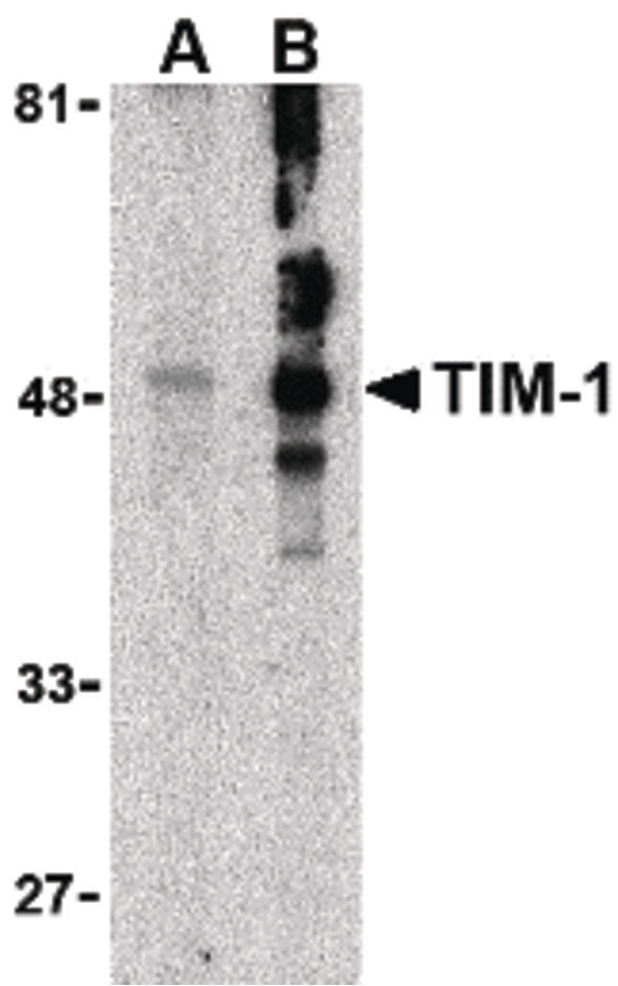 Western blot of TIM-1 in human uterus tissue lysate with TIM-1 antibody at (A) 1 and (B) 2 ug/ml.