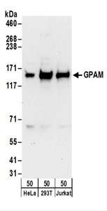 Detection of Human GPAM by Western Blot. Samples: Whole cell lysate (50 ug) from HeLa, 293T, and Jurkat cells. Antibodies: Affinity purified rabbit anti-GPAM antibody used for WB at 1 ug/ml. Detection: Chemiluminescence with an exposure time of 30 seconds.