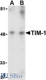 Western blot of TIM-1 in human uterus tissue lysate with TIM-1 antibody at (A) 1 and (B) 2 ug/ml.