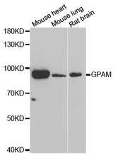 Western blot analysis of extracts of various cell lines, using GPAM antibody.