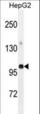 GPAM Antibody western blot of HepG2 cell line lysates (35 ug/lane). The GPAM antibody detected the GPAM protein (arrow).