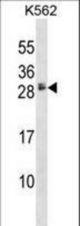 HBEGF Antibody western blot of K562 cell line lysates (35 ug/lane). The HBEGF antibody detected the HBEGF protein (arrow).