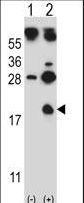 Western blot of HBG1 (arrow) using rabbit polyclonal HBG1 Antibody. 293 cell lysates (2 ug/lane) either nontransfected (Lane 1) or transiently transfected (Lane 2) with the HBG1 gene.