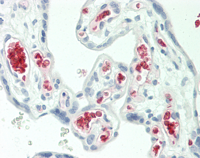 Human Placenta: Formalin-Fixed, Paraffin-Embedded (FFPE)