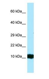 HBG2 antibody Western Blot of Fetal Kidney.