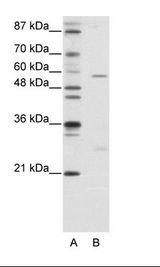 A: Marker, B: Jurkat Cell Lysate