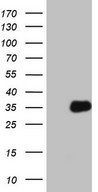 HEK293T cells were transfected with the pCMV6-ENTRY control (Left lane) or pCMV6-ENTRY FGFBP1 (Right lane) cDNA for 48 hrs and lysed. Equivalent amounts of cell lysates (5 ug per lane) were separated by SDS-PAGE and immunoblotted with anti-FGFBP1 (1:2000).