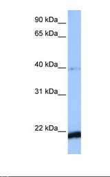 MCF7 cell lysate. Antibody concentration: 1.0 ug/ml. Gel concentration: 12%.