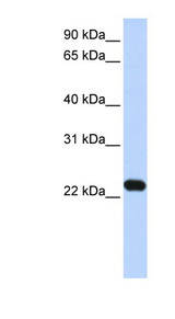 HBXIP antibody LS-C111379 Western blot of Transfected 293T cell lysate.