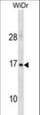 HBZ Antibody western blot of WiDr cell line lysates (35 ug/lane). The HBZ antibody detected the HBZ protein (arrow).