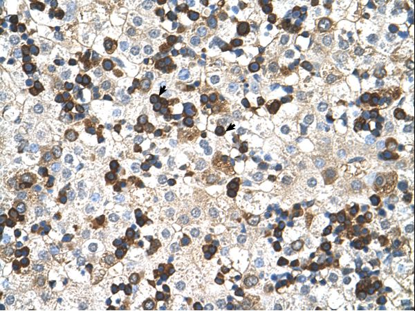 HBZ antibody LS-C40373 was used in IHC to stain formalin-fixed, paraffin-embedded human liver.