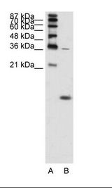 A: Marker, B: K562 Cell Lysate