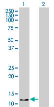 Western blot of HBZ expression in transfected 293T cell line by HBZ monoclonal antibody (M03), clone 1G10.