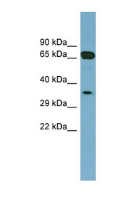 GLOD4 antibody LS-C107816 Western blot of Placenta lysate.