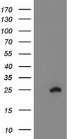 HEK293T cells were transfected with the pCMV6-ENTRY control (Left lane) or pCMV6-ENTRY FAM119A (Right lane) cDNA for 48 hrs and lysed. Equivalent amounts of cell lysates (5 ug per lane) were separated by SDS-PAGE and immunoblotted with anti-FAM119A.