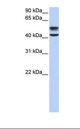 Fetal liver lysate. Antibody concentration: 1.0 ug/ml. Gel concentration: 12%.
