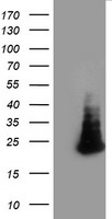 HEK293T cells were transfected with the pCMV6-ENTRY control (Left lane) or pCMV6-ENTRY FAM119A (Right lane) cDNA for 48 hrs and lysed. Equivalent amounts of cell lysates (5 ug per lane) were separated by SDS-PAGE and immunoblotted with anti-FAM119A.