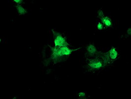 Anti-FAM119A mouse monoclonal antibody immunofluorescent staining of COS7 cells transiently transfected by pCMV6-ENTRY FAM119A.