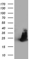 HEK293T cells were transfected with the pCMV6-ENTRY control (Left lane) or pCMV6-ENTRY FAM119A (Right lane) cDNA for 48 hrs and lysed. Equivalent amounts of cell lysates (5 ug per lane) were separated by SDS-PAGE and immunoblotted with anti-FAM119A.