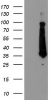 HEK293T cells were transfected with the pCMV6-ENTRY control (Left lane) or pCMV6-ENTRY FAM119A (Right lane) cDNA for 48 hrs and lysed. Equivalent amounts of cell lysates (5 ug per lane) were separated by SDS-PAGE and immunoblotted with anti-FAM119A.
