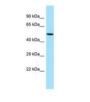 Western blot of Human HT1080. GPATCH4 antibody dilution 1.0 ug/ml.